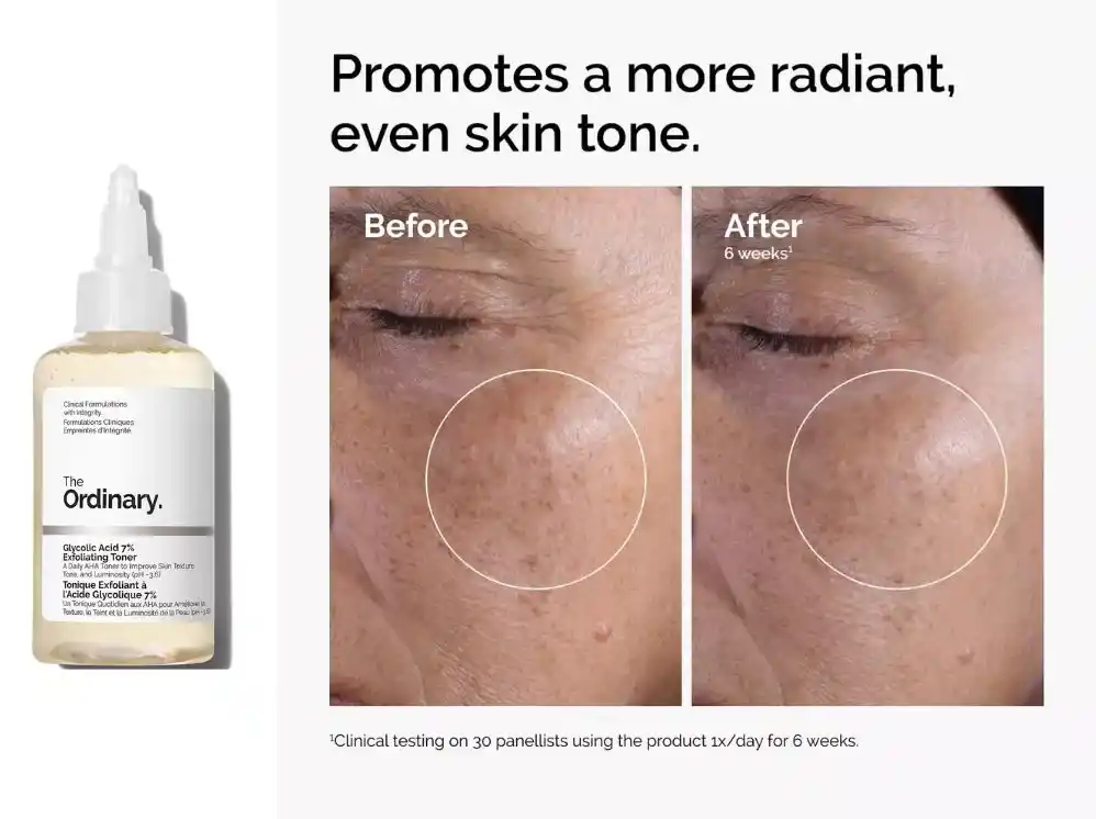The Ordinary Glycolic Acid 7% review